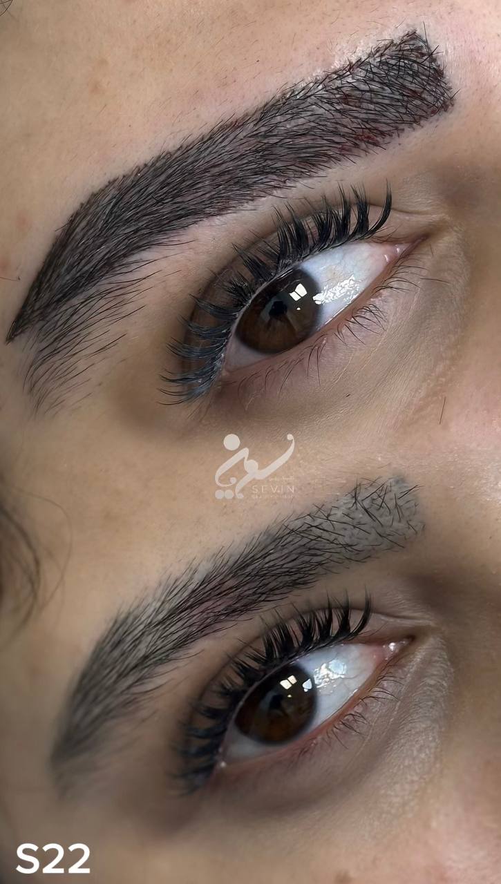 نمونه کاشت ابرو در کلینیک سوین